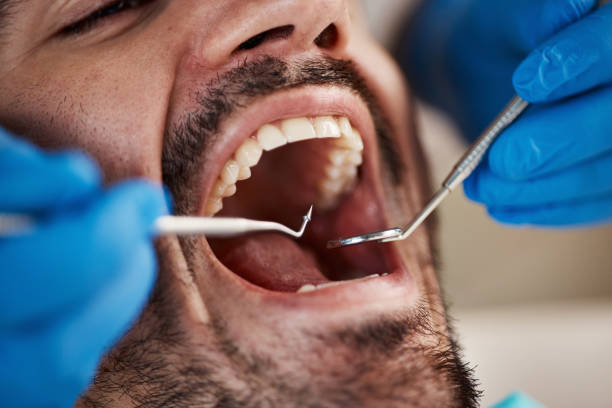 Best Walk-In Emergency Dentist in Allen, TX